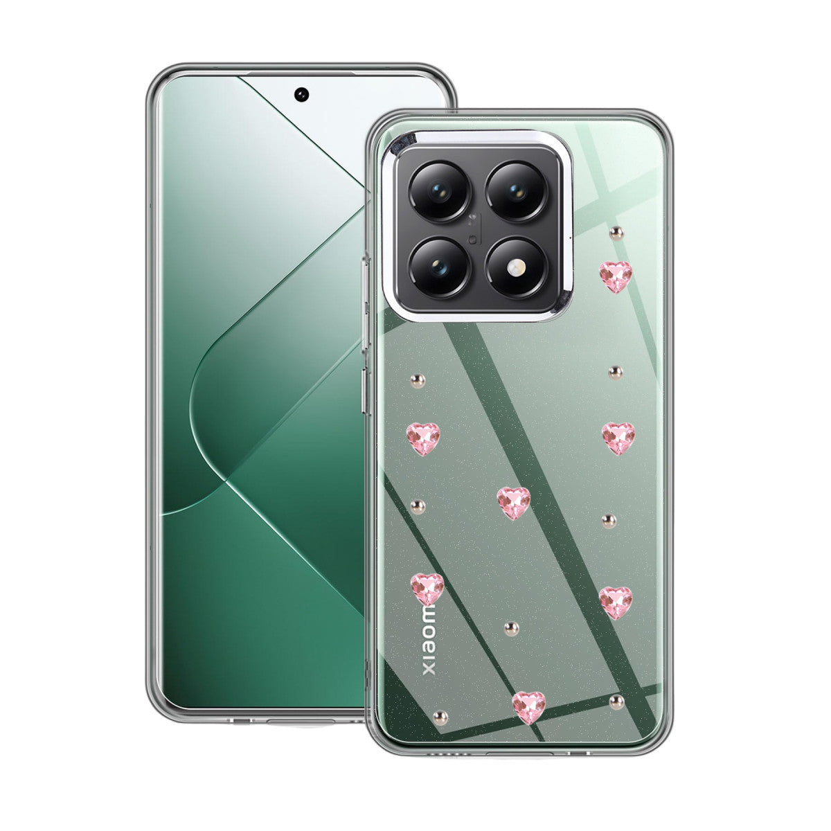 Mi 14T Pro Fiyonk Desenli Kapak - Desen 3