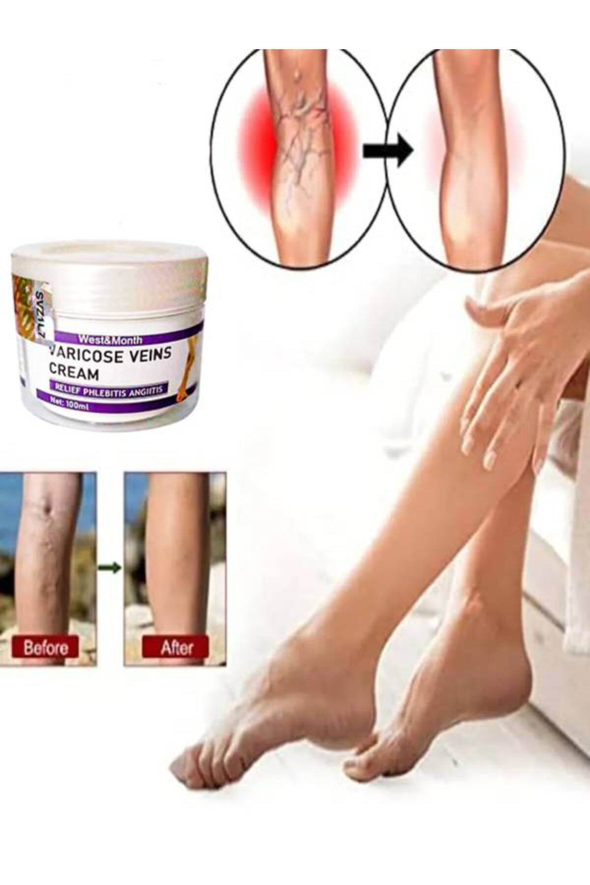 West & Month Varicose Vein Va.ris Karşıtı Kremi100 ml 2 Adet