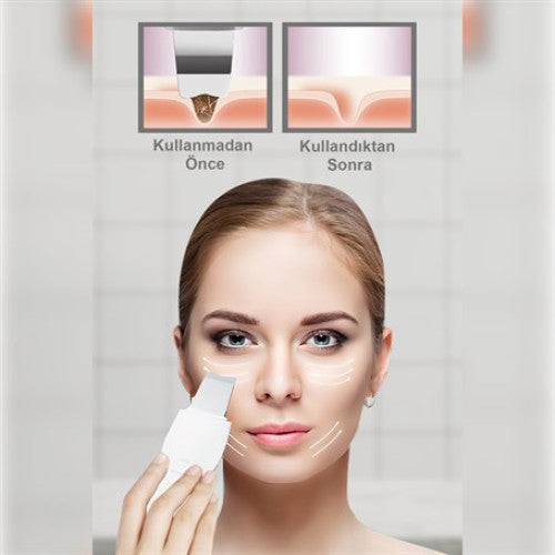 ULTRASONIC SİYAH NOKTA AKNE SPATULA ŞARJLI CİLT TEMİZLEYİCİ