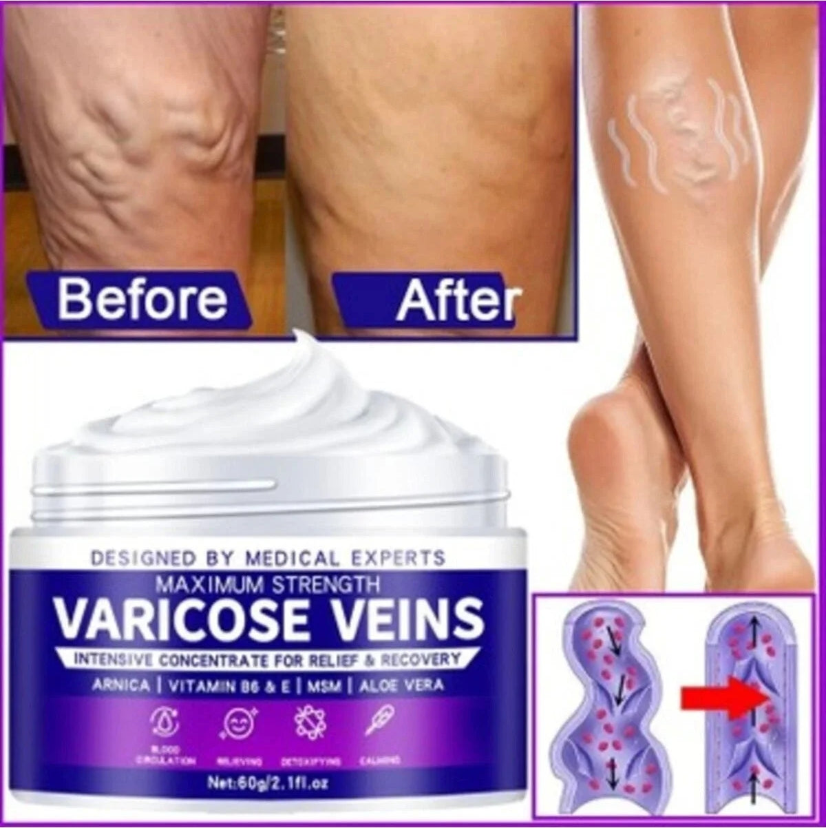Strngth V.ricose Ve.n Tedavi Kremi 100 ml x 3 Adet