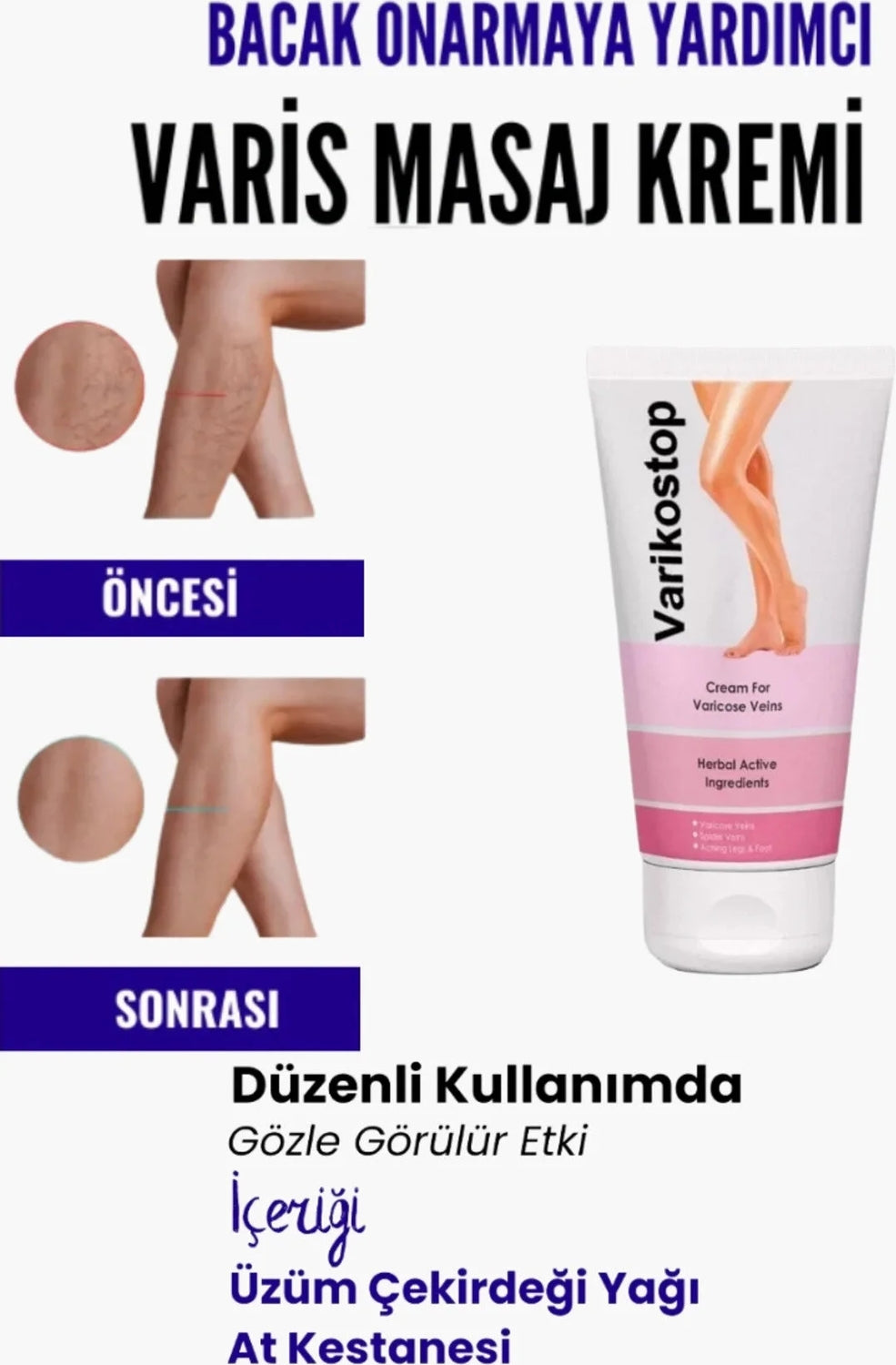Bölgesi Için Bacak Varikostop Masaj Kremi 200 ml