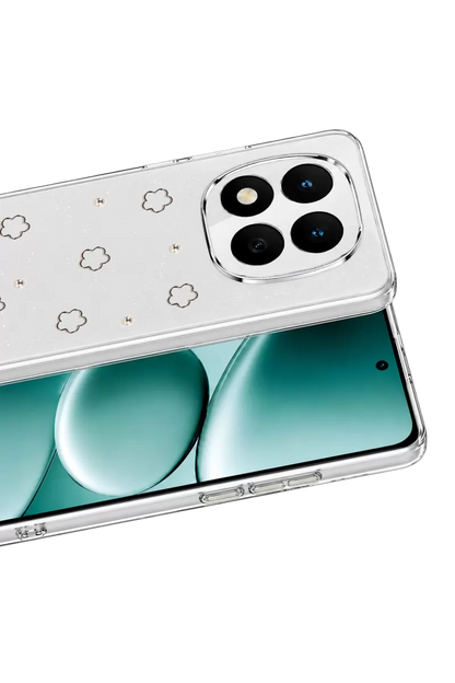 Note 15 4G Fiyonk Desenli Kapak - Desen 2