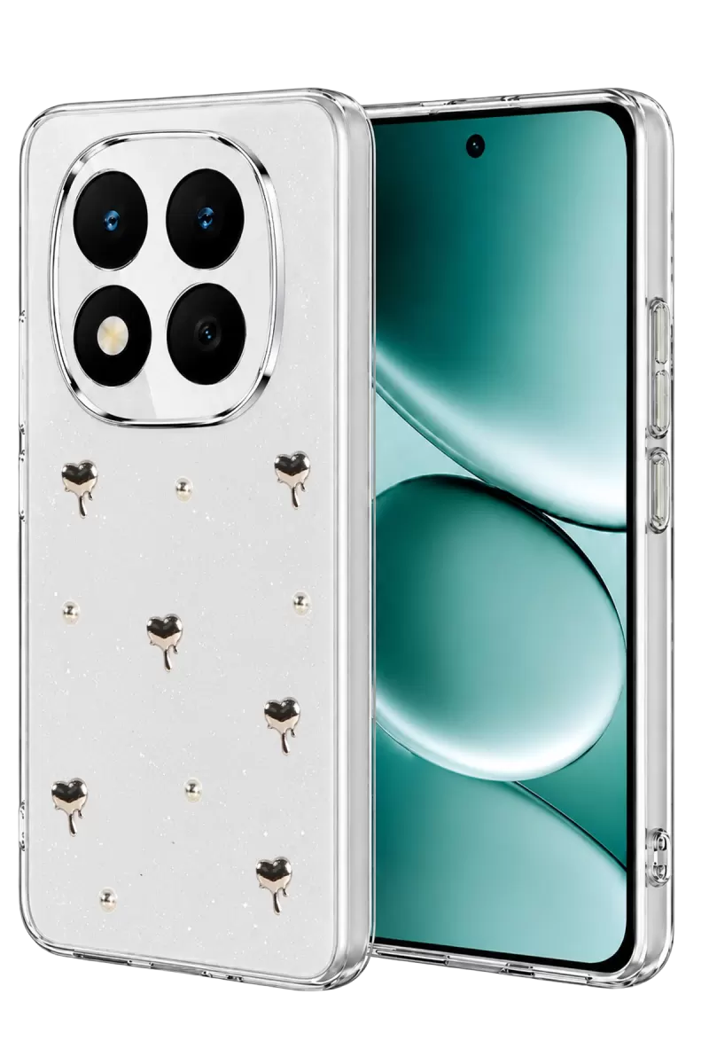 Note 15 Pro Plus 5G Fiyonk Desenli Kapak - Desen 1