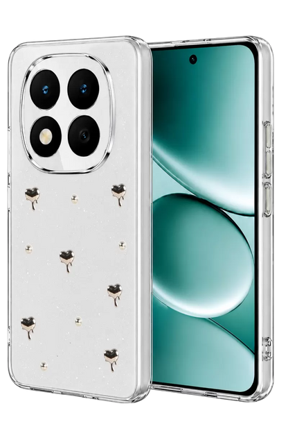 Note 15 Pro Plus 5G Fiyonk Desenli Kapak - Desen 1
