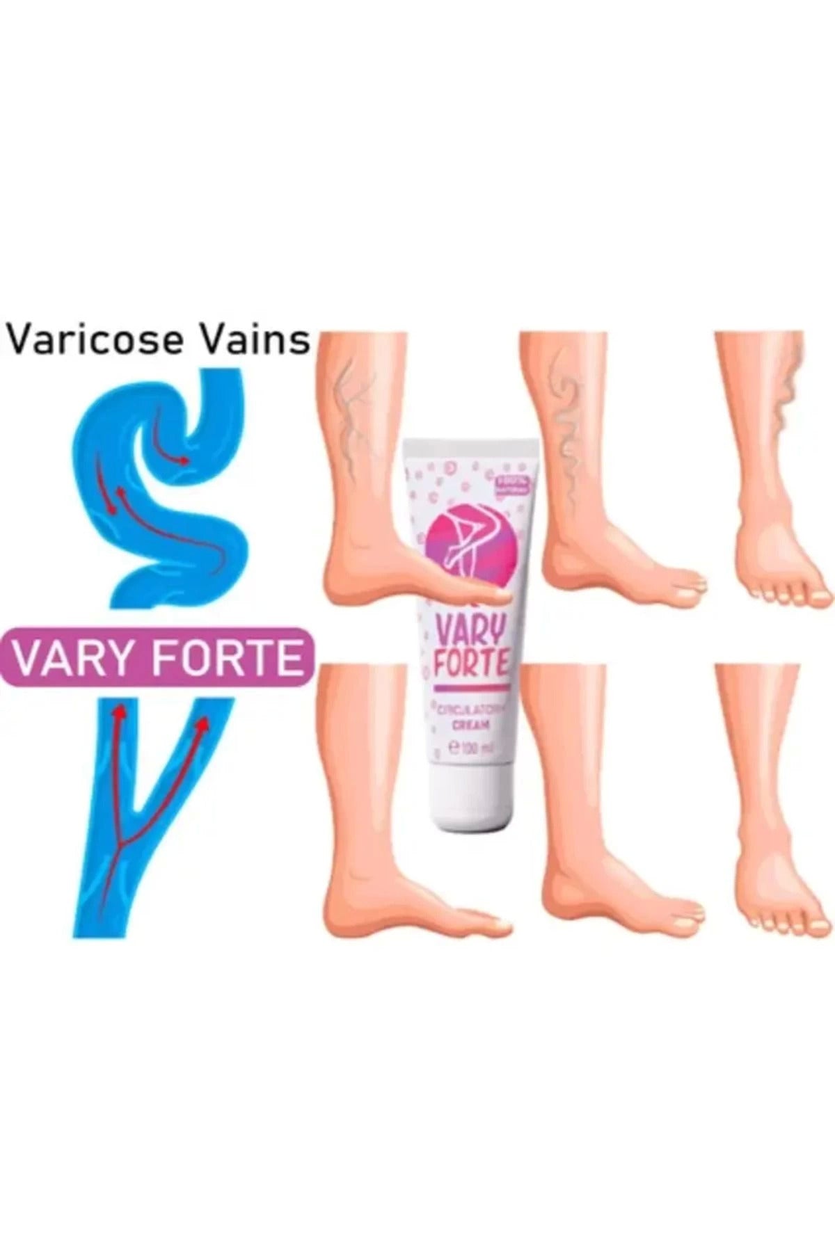 Vary Forte Tüp Yoğun Varislerinize Güçlü Etkide Krem 100 ml