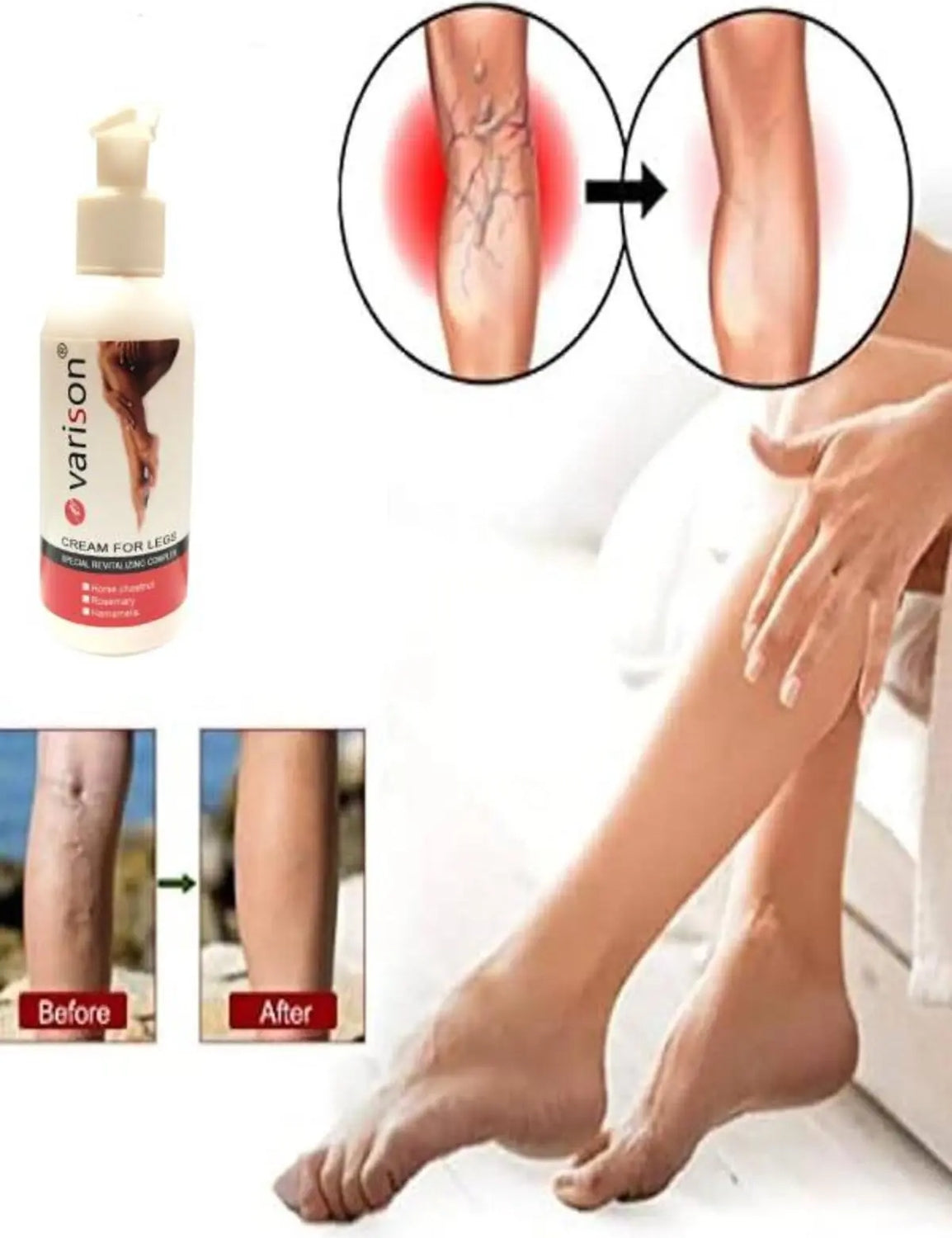 Süper Varison Bacak Bakım Kremi 120 ml