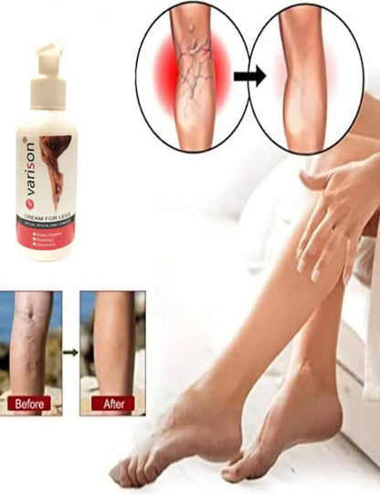 Süper Varison Bacak Bakım Kremi 120 ml