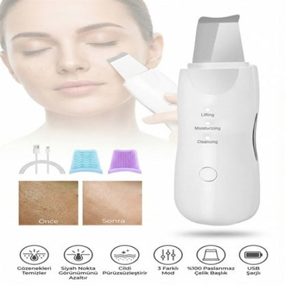 ULTRASONIC SİYAH NOKTA AKNE SPATULA ŞARJLI CİLT TEMİZLEYİCİ